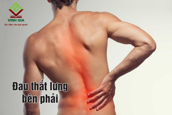 Tình trạng đau thắt lưng phải báo hiệu tổn thương cơ, dây chằng