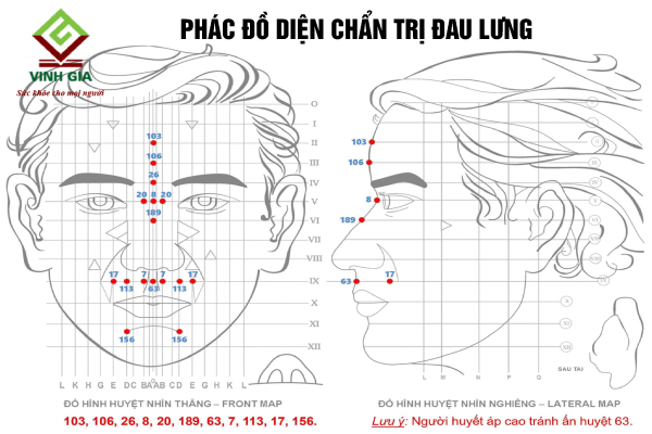 Tùy vào nguyên nhân gây đau lưng để diện chẩn vào các huyệt vị tương ứng Tùy vào nguyên nhân gây đau lưng để diện chẩn vào các huyệt vị tương ứng