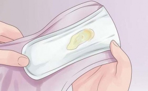 Ngứa vùng kín và ra dịch vàng có nguy hiểm không? Ngứa vùng kín và ra dịch vàng có nguy hiểm không?