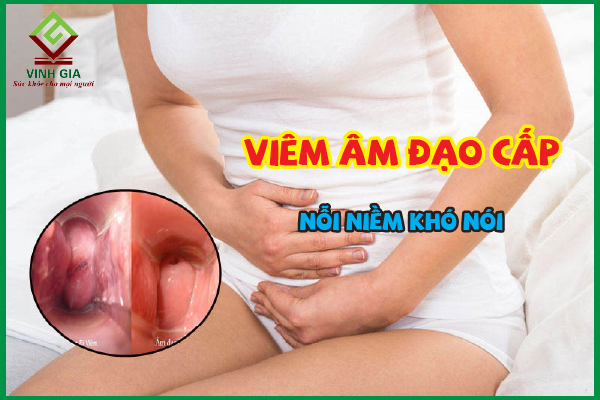 Viêm âm đạo cấp: Nỗi niềm khó nói của nhiều phụ nữ