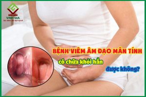 Bệnh viêm âm đạo mãn tính có chữa khỏi hẳn được không?