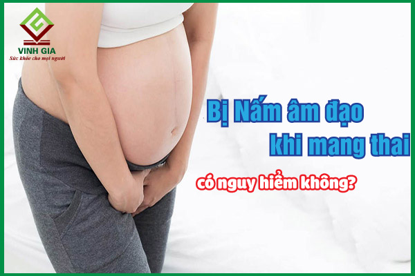 Nấm âm đạo khi mang thai: Nguyên nhân và cách điều trị