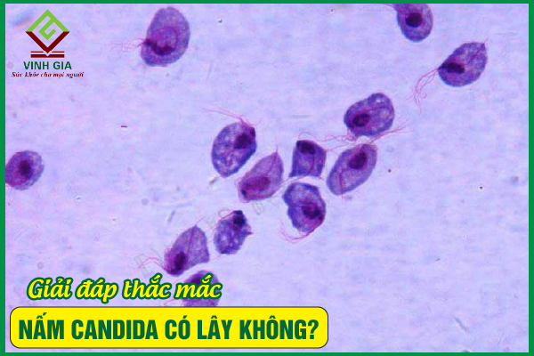 Viêm nhiễm do nấm candida có lây không?