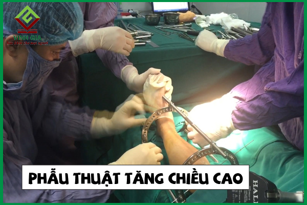 Hiểu rõ hơn về phương pháp phẫu thuật tăng chiều cao