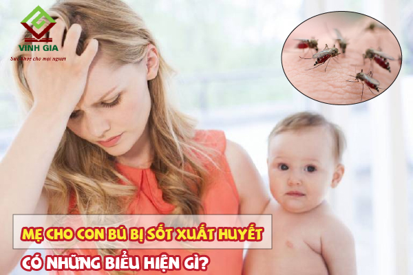 Mẹ cho con bú bị sốt xuất huyết có những biểu hiện gì?