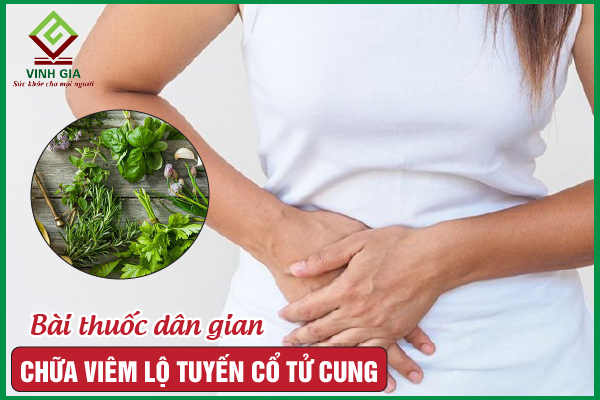 11 Bài thuốc dân gian chữa viêm lộ tuyến cổ tử cung tốt nhất