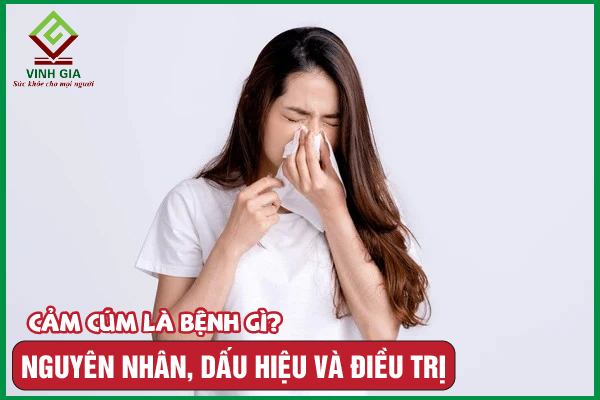 Cảm cúm là bệnh gì? Nguyên nhân, triệu chứng và điều trị