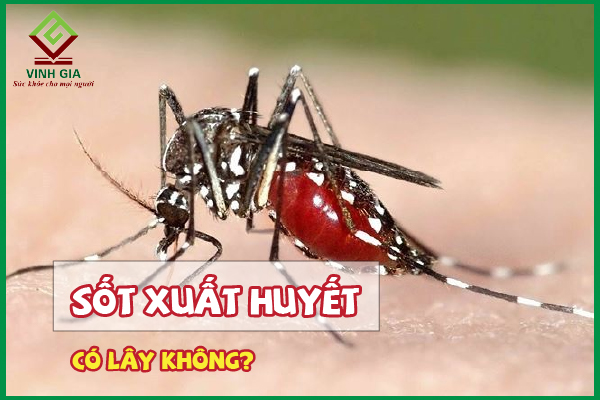 Bệnh sốt xuất huyết có lây không? Lây qua đường nào?