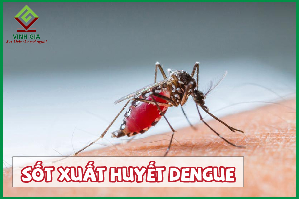 Sốt xuất huyết Dengue: Cảnh giác với biến chứng nguy hiểm
