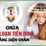 Giảm rối loạn tiền đình bằng diện chẩn có hiệu quả không?