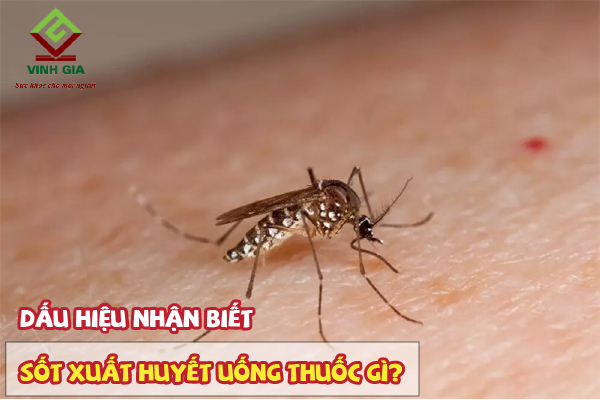 Nắm rõ biểu hiện sốt xuất huyết để lựa chọn thuốc điều trị phù hợp Nắm rõ biểu hiện sốt xuất huyết để lựa chọn thuốc điều trị phù hợp