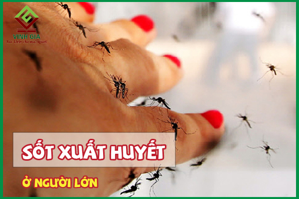 Sốt xuất huyết ở người lớn: Triệu chứng và cách chữa bệnh