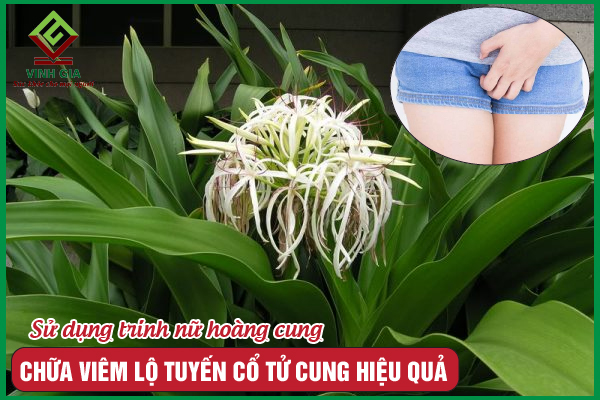 Trinh nữ hoàng cung chữa viêm lộ tuyến như thế nào?