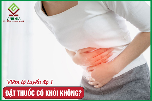 Liệu viêm lộ tuyến độ 1 đặt thuốc có khỏi không?