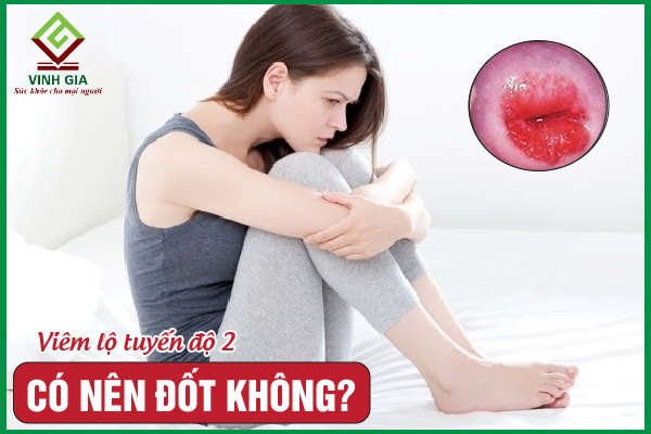 Viêm lộ tuyến cổ tử cung độ 2 có nên đốt không?