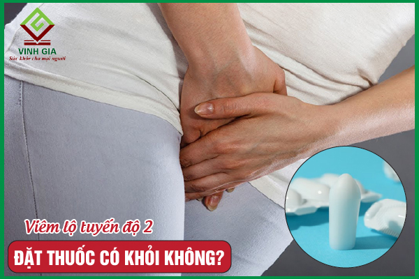 Viêm lộ tuyến độ 2 đặt thuốc có khỏi không?