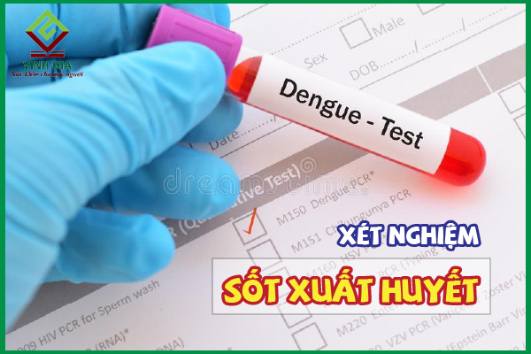 Xét nghiệm sốt xuất huyết như thế nào? Giá bao nhiêu tiền?
