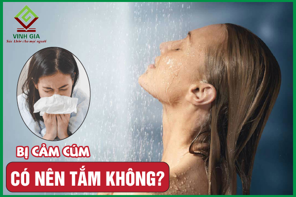 Người bị cảm cúm có nên tắm không? Làm gì để cải thiện?