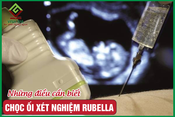 Khi nào cần chọc ối xét nghiệm Rubella?
