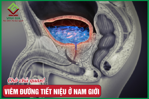 Viêm đường tiết niệu ở nam giới là gì? Cách điều trị hiệu quả