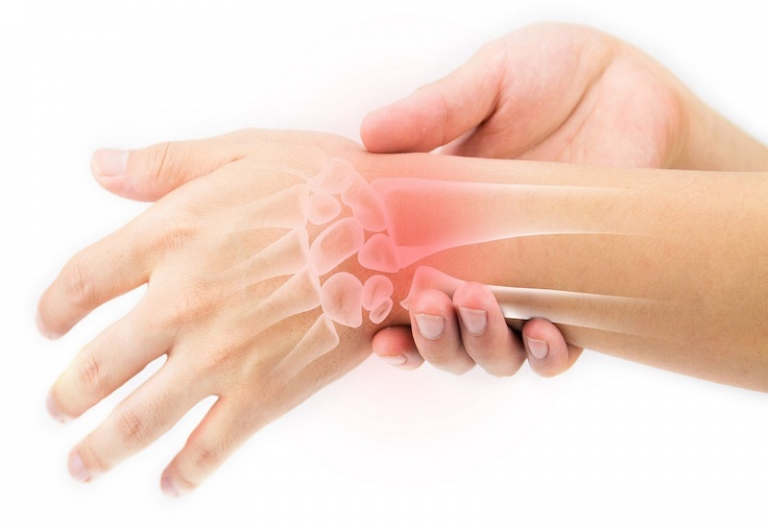 Bạn có biết chi phí phẫu thuật hội chứng ống cổ tay bao nhiêu tiền?