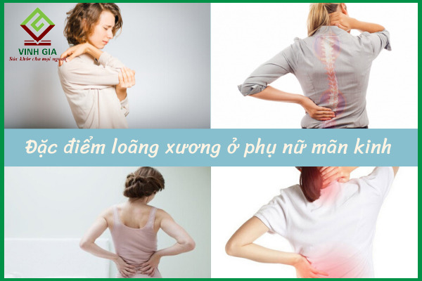 Loãng xương ở phụ nữ mãn kinh: Hiểu để điều trị hiệu quả
