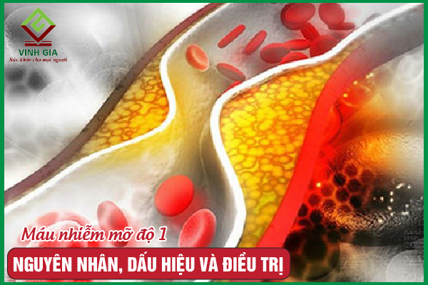 Máu nhiễm mỡ độ 1 là gì? Nguyên nhân và cách cải thiện