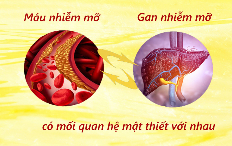 Máu nhiễm mỡ và gan nhiễm mỡ khác nhau như thế nào?
