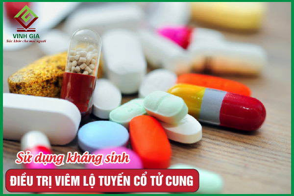 Tại sao dùng kháng sinh điều trị viêm lộ tuyến cổ tử cung?