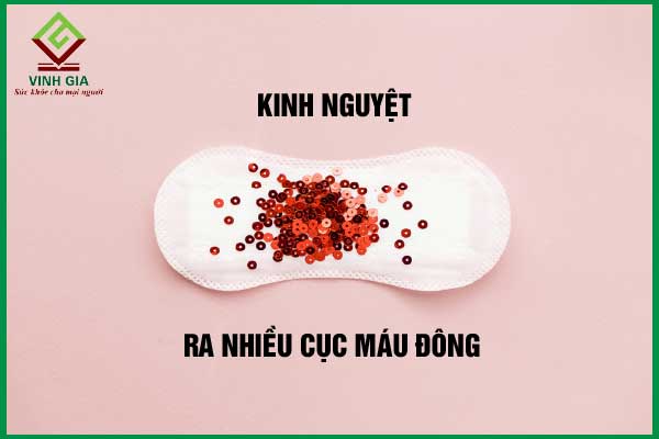 cách chế tạo nguyệt ảnh thạch