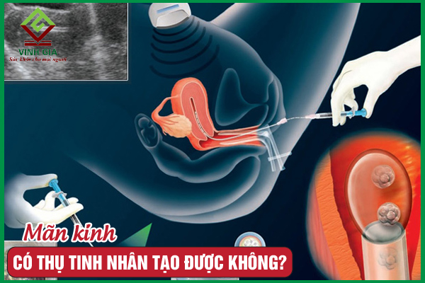 [GIẢI ĐÁP] Mãn Kinh Có Thụ Tinh Nhân Tạo Được Không?