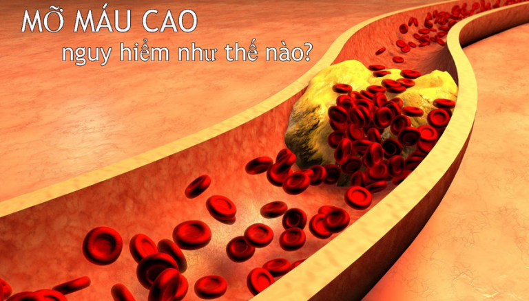[GIẢI ĐÁP THẮC MẮC] Máu nhiễm mỡ có nguy hiểm không?