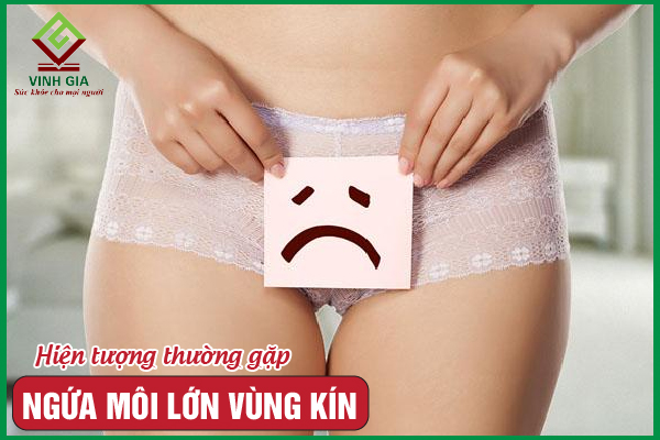 Ngứa môi lớn vùng kín: Nguyên nhân và cách điều trị triệt để