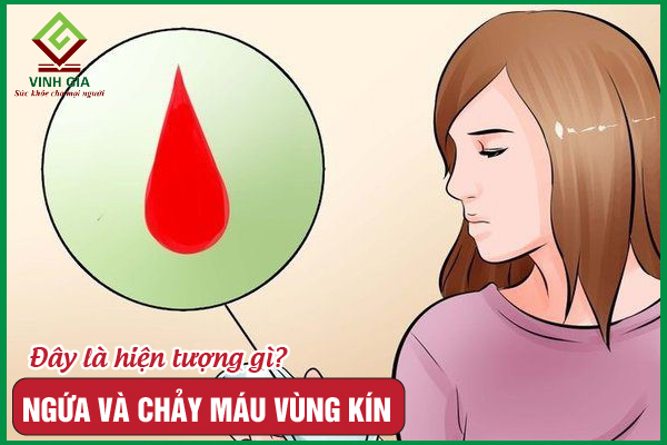 Nếu ngứa và chảy máu vùng kín, cần khắc phục ngay!