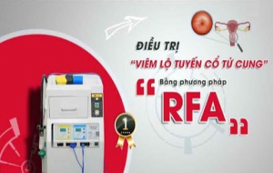 Cần tuân thủ nghiêm ngặt quy trình điều trị viêm lộ tuyến bằng sóng cao tần RFA