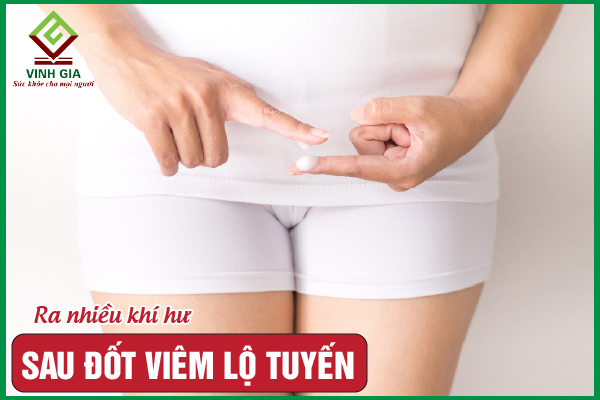 Sau khi đốt lộ tuyến vẫn ra khí hư có đáng lo ngại không?