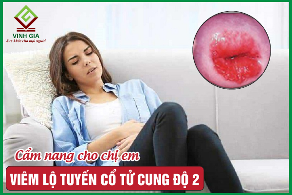 Viêm lộ tuyến cổ tử cung độ 2: Điều trị như thế nào?
