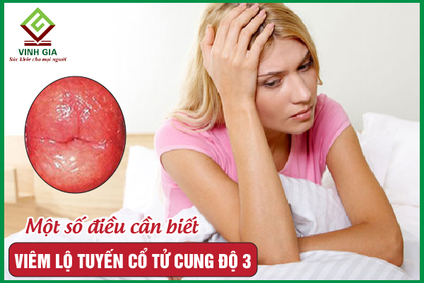 Viêm lộ tuyến cổ tử cung độ 3: Làm gì để điều trị dứt điểm?