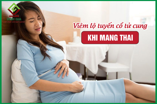 Viêm lộ tuyến cổ tử cung khi mang thai: Cần phải làm gì?