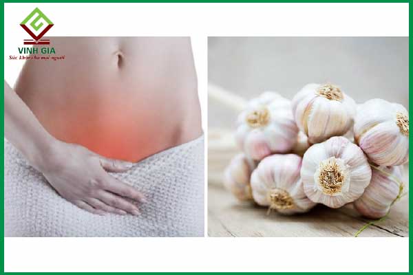 Chữa viêm âm đạo bằng tỏi có hiệu quả không?