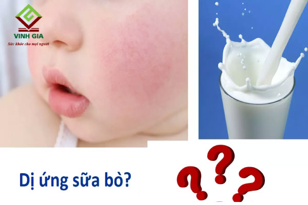 Dị ứng sữa có thể gây tình trạng uống sữa bị tiêu chảy