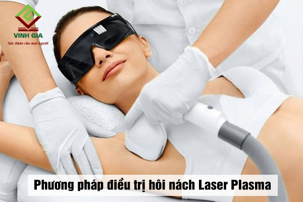 Điều trị hôi nách bằng phương pháp Laser Plasma