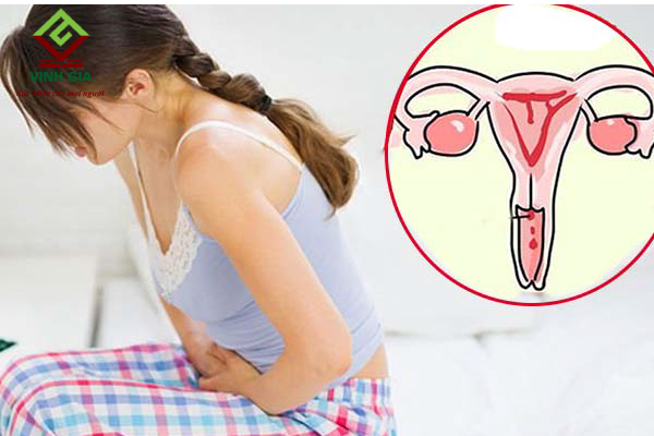 Liệu viêm cổ tử cung có gây chậm kinh không?