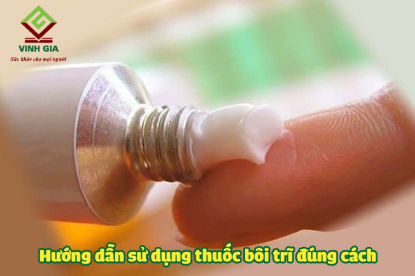 Nên sử dụng thuốc bôi trĩ đúng cách, đúng chỉ định để phát huy hiệu quả của thuốc Nên sử dụng thuốc bôi trĩ đúng cách, đúng chỉ định để phát huy hiệu quả của thuốc