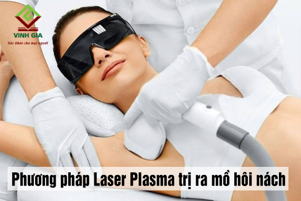 Phương pháp Laser Plasma trị ra mồ hôi nách hiệu quả