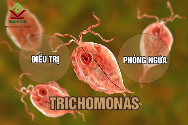 Phương pháp điều trị và phòng ngừa cho người bị nhiễm trùng roi Trichomonas