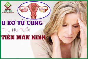 U xơ tử cung ở tuổi tiền mãn kinh