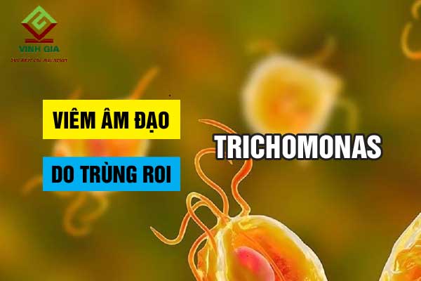 Viêm âm đạo do nhiễm trùng roi Trichomonas là bệnh gì?