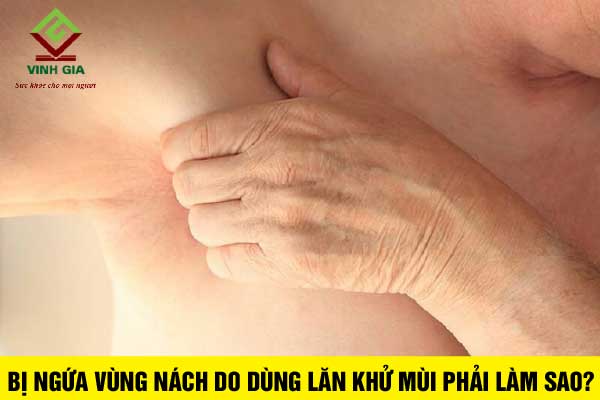 Bị ngứa vùng nách khi dùng lăn khử mùi phải làm sao?