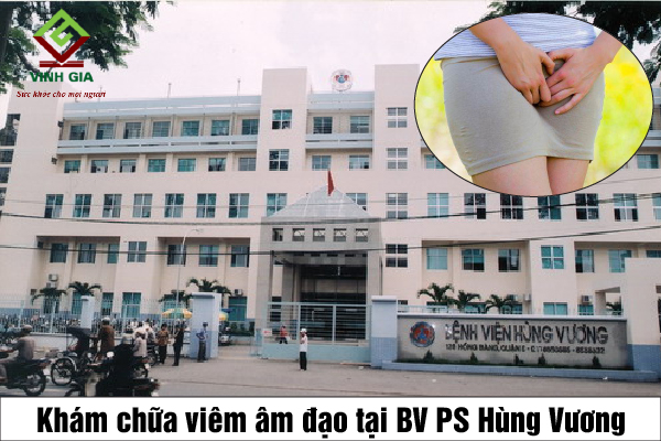 Khám điều trị tình trạng viêm âm đạo ở Bệnh viện Phụ sản Hùng Vương